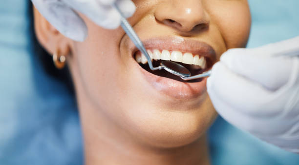 Best Broken or Cracked Tooth Emergency Dentist in Auburn, ME
